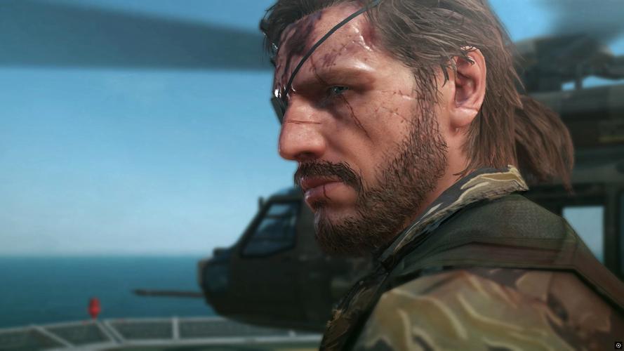 合金装备5：幻痛游戏下载详细教程