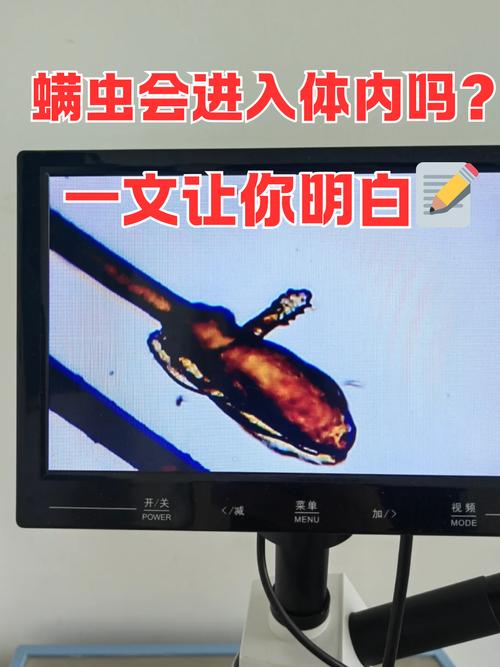 内部寄生虫安卓：深度解析与解决方案