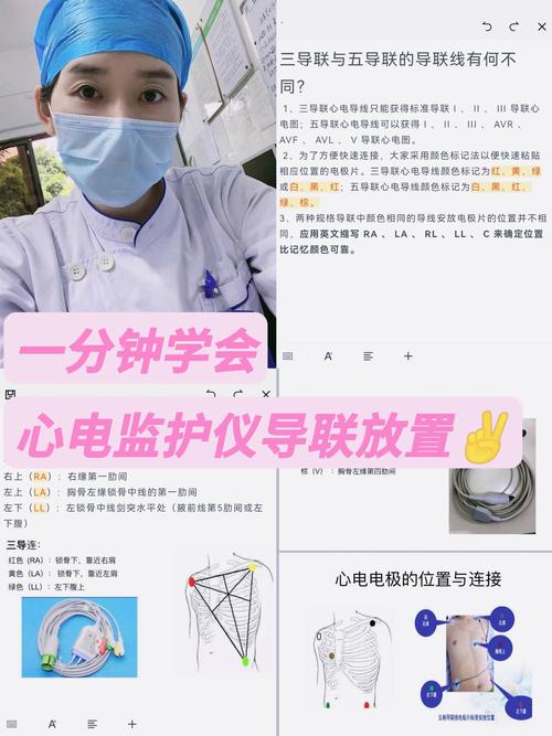 如何下载与安装《监护人：守护者-内有米勒》游戏的详细教程