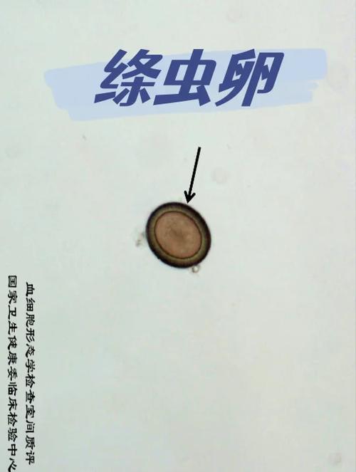 内部寄生虫最新版本分析及其在游戏中的影响